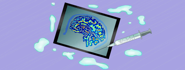 FDA Approved Diagnostic Tool for Parkinson’s: Fluorodopa F 18 image